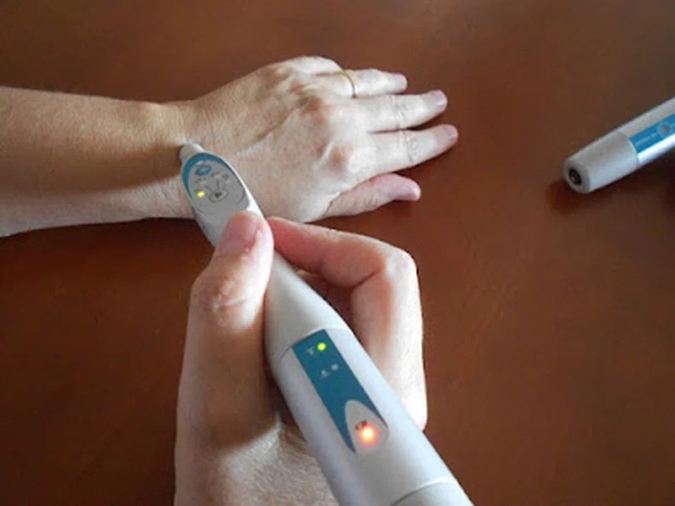 acupunctura na Clínica FIRSTHEALTH