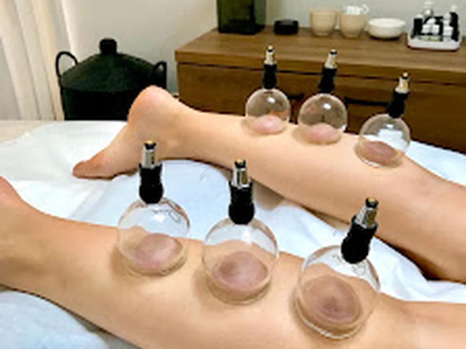 Acupuncture In Lisbon