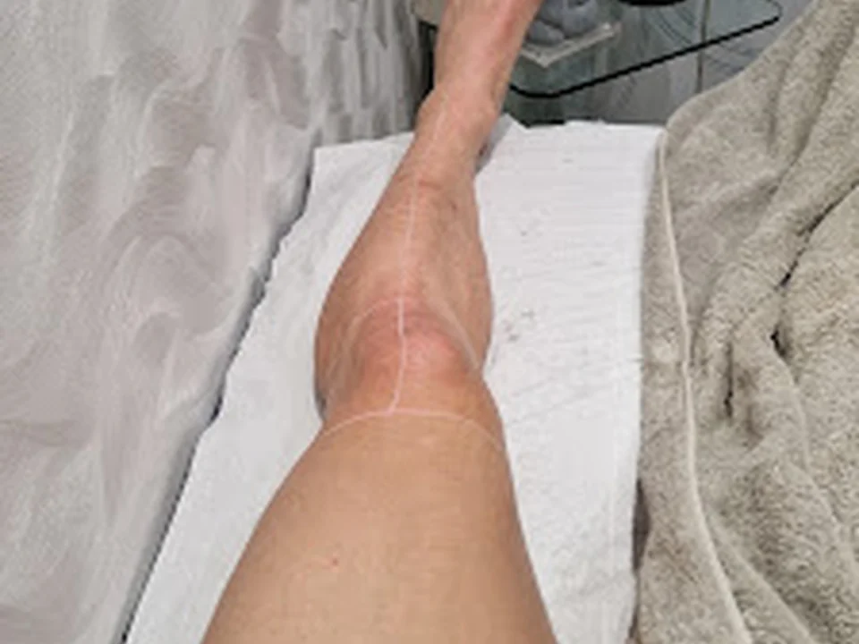 LX2 Clínica - Depilação a Laser Alexandrite & Estética, Lisboa